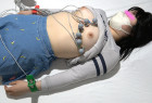 吸引具で真っ赤な跡が付いてしまったティーン患者の心電図検査。ピンク乳輪をもつおさな顔患者の胸を盗撮！