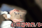 【再販】【検診/心電図】過去作ダイジェスト公開!! 美女の心電図シーン詰め合わせ!